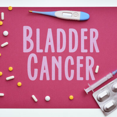 Bladder Cancer: Symptoms, Causes and Types