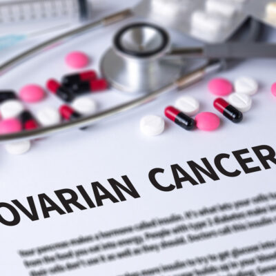 Ovarian Cancer Treatment Options