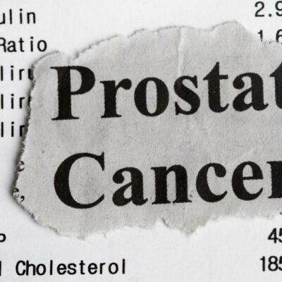 Major Causes and Treatments for Prostate Cancer