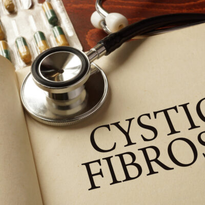 Managing and Treating Cystic Fibrosis