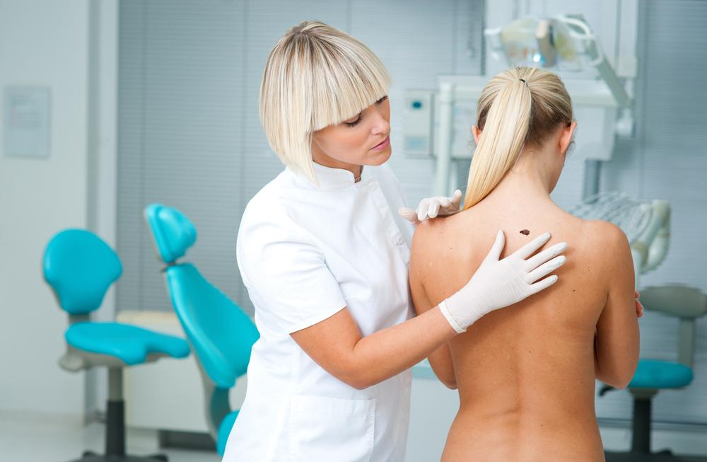 Melanoma Skin Cancer: Screening and Treatments