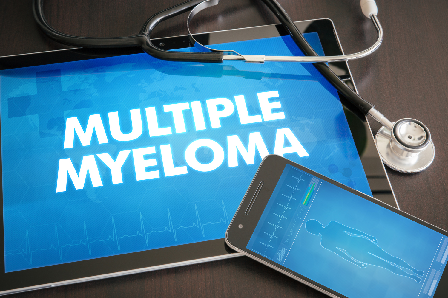 Multiple Myeloma Treatment Options