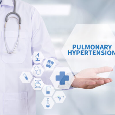 What Causes Pulmonary Arterial Hypertension