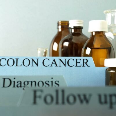 Treatment Options for Colon Cancer