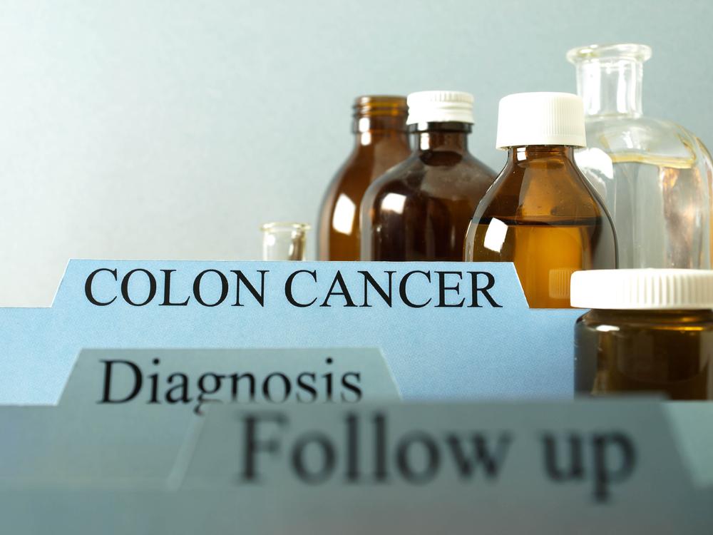 Treatment Options for Colon Cancer