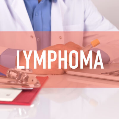 Understanding Lymphoma: Types and Causes